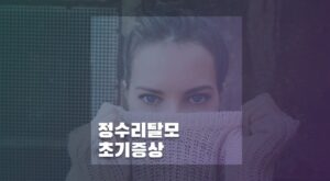 정수리탈모초기증상